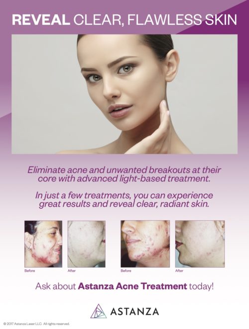 Astanza Acne Treatment Table Top