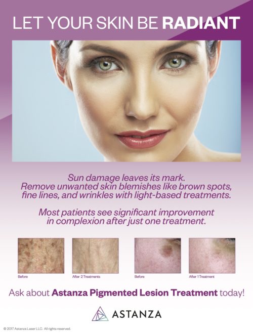 Astanza Pigmented Lesion Poster