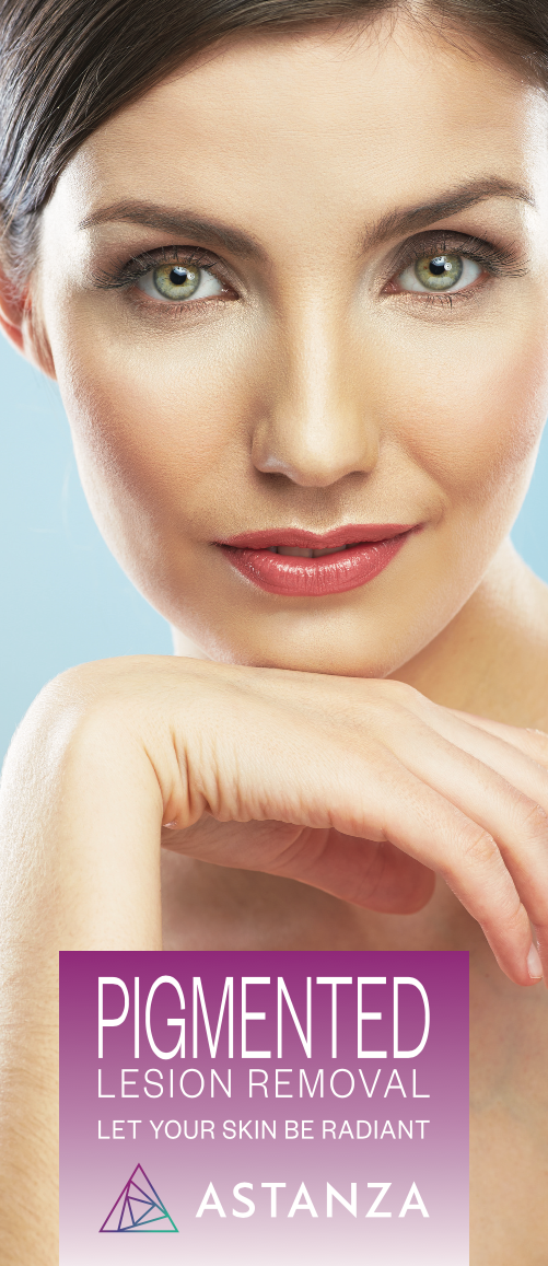 Astanza Pigmented Lesion Brochures