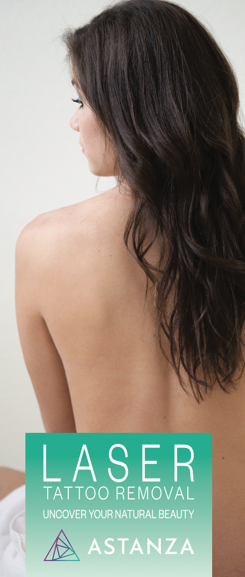 Astanza Laser Tattoo Removal Brochures