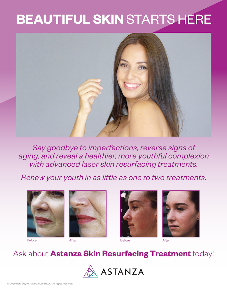 Astanza Skin Resurfacing Table Top