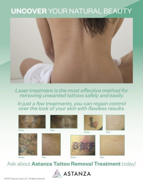 Astanza Laser Tattoo Removal Poster