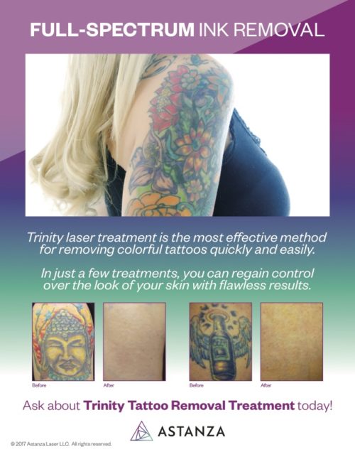Astanza Trinity Tattoo Removal Table Top
